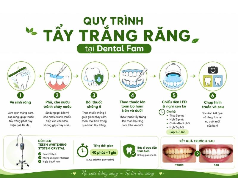 The six-step whitening procedure at Dental Fam with the Crystal LED lamp, 40 minutes to an hour